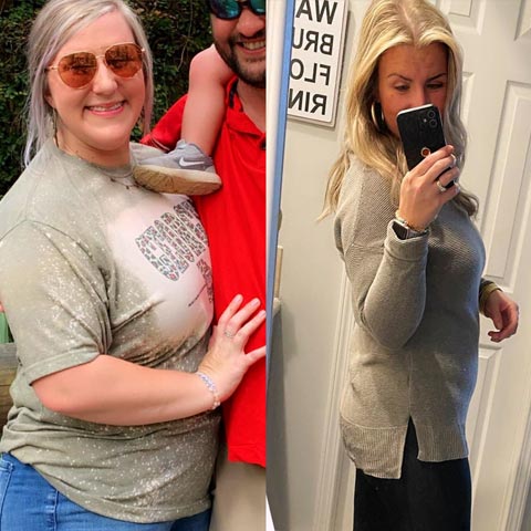 Michelle's before and after health transformation